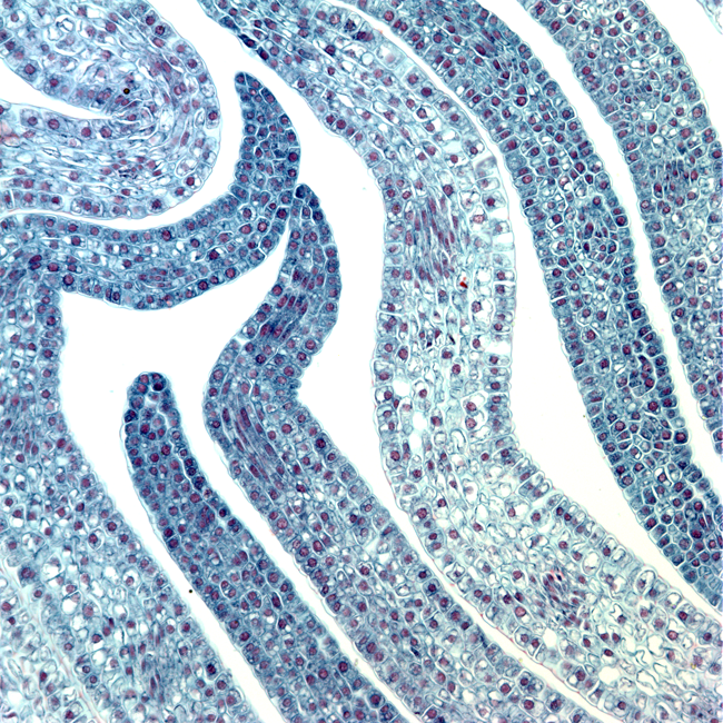 Peony (Safranin O & Fast Green) a cross section of peony cells, taken with a light microscope