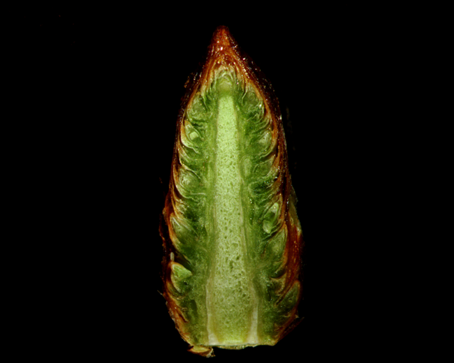 Spruce (Dissecting Scope) a microscopic image of a dissection of a spruce cone, taken with a light microscope