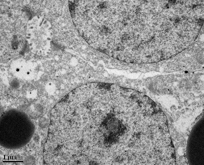 Pacific Hagfish Liver Cells microscopic image of a pacific hagfish's liver cells, taken with a transmission electron microscope