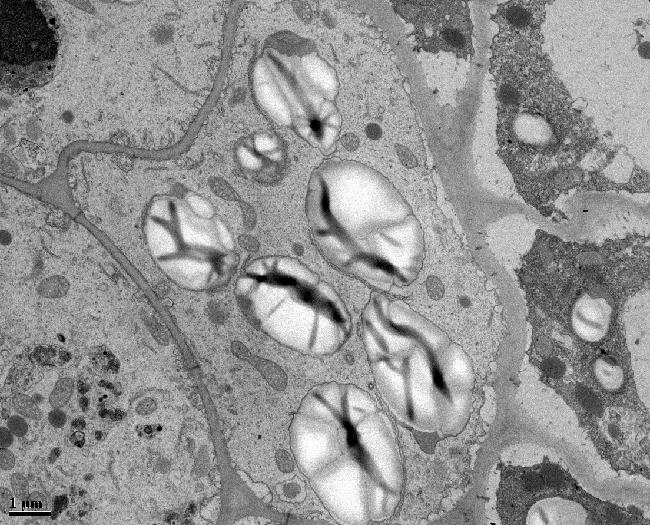 Plant Cell with Large Starch Granules microscopic image of a plant cell with 7 large starch granules, taken with a transmission electron microscope