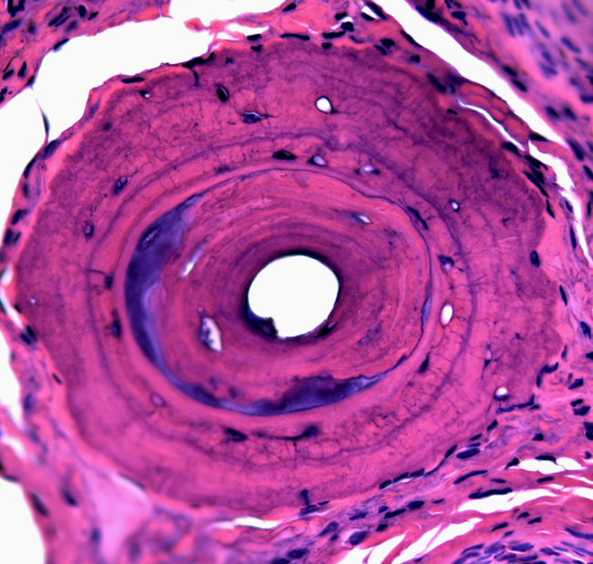 Cross Section of an Amphibian Toe a microscopic image of a cross section of an amphibian's toe, taken with a light microscope