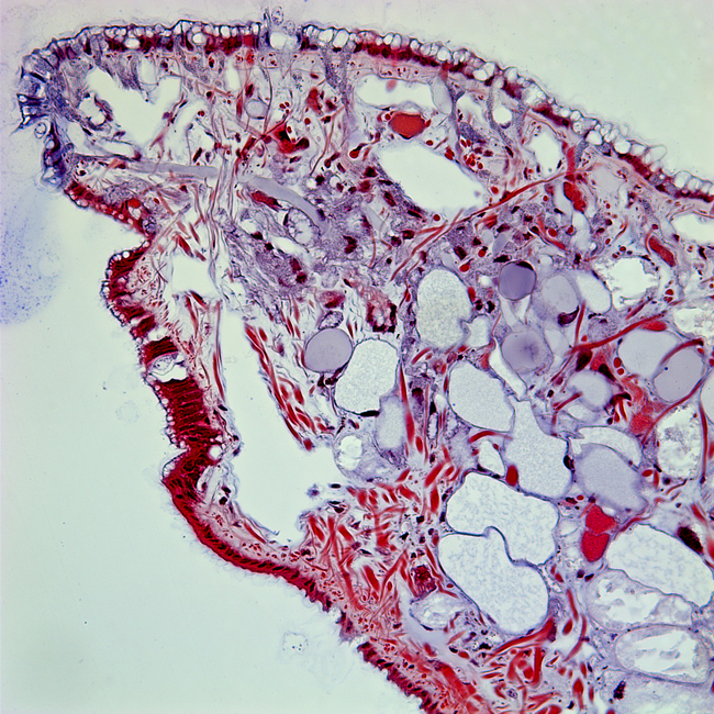 Tadpole Snail (Masson a cross section of tadpole snail cells, taken with a light microscope
