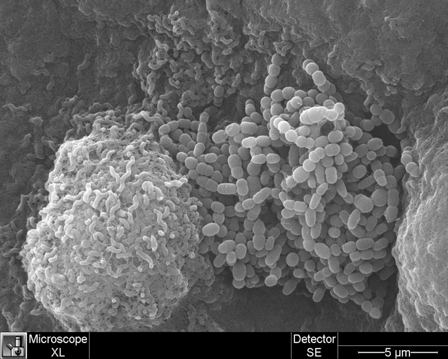 Campylobacter Jejuni (left) with Unidentified Microbes (right) 3D image of campylobacter jejuni and unidentified microbes, taken with a scanning electron microscope