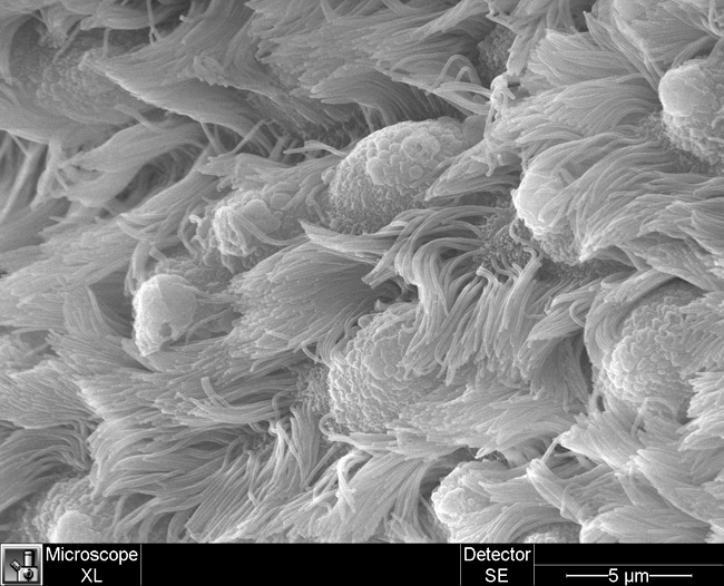 Ciliated Respiratory Epithelium (high mag) a high magnification image of ciliated respiratory epithelium in lungs, taken with a scanning electron microscope