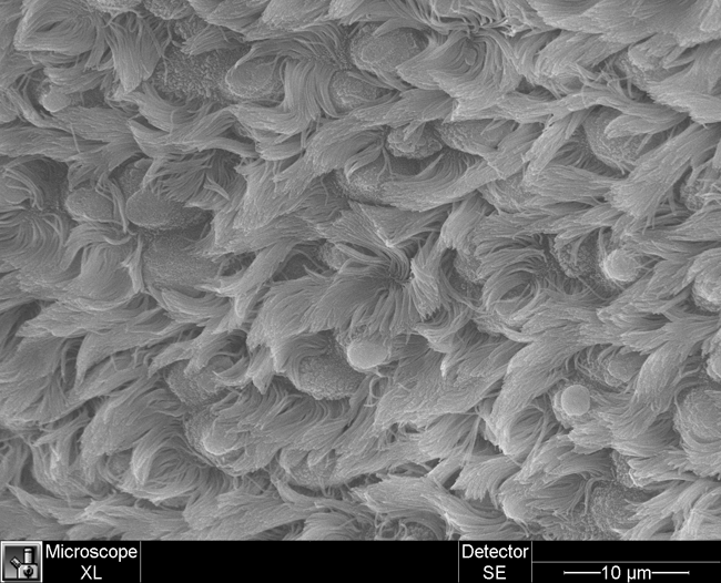 Ciliated Respiratory Epithelium, 2 (high mag) a high magnification image of lung cells (ciliated respiratory epithelium), taken with a scanning electron microscope