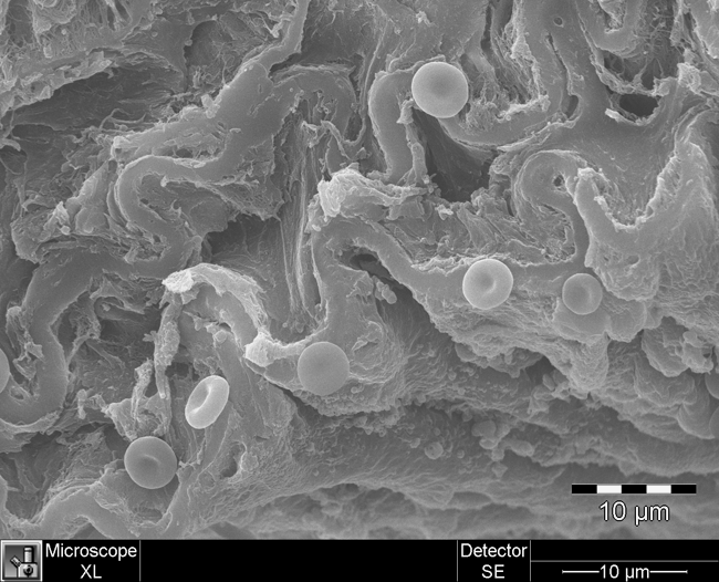 Mouse Artery Wall, Showing Wavy Elastin and Red Blood Cells 3D image of a mouse artery wall with wavy elastin and red blood cells, taken with a scanning electron microscope