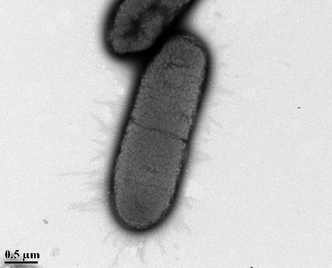 Bacteria with Pili (negative stain) a negative stain of bacteria cells with pili, taken with a transmission electron microscope