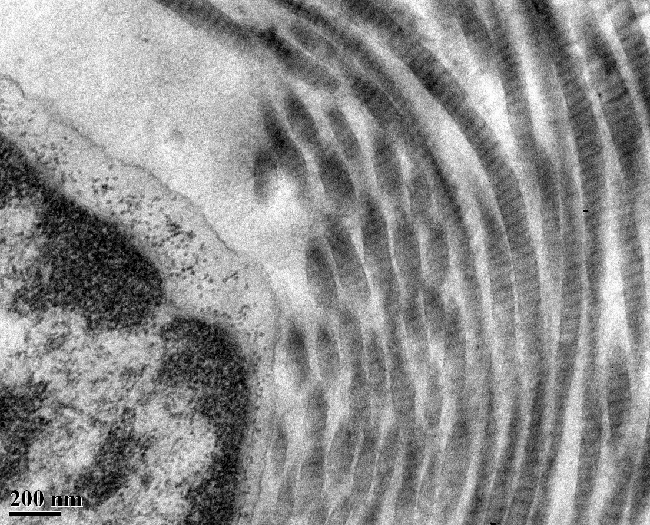 Collagen fibers collagen fibers, taken with a transmission electron microscope