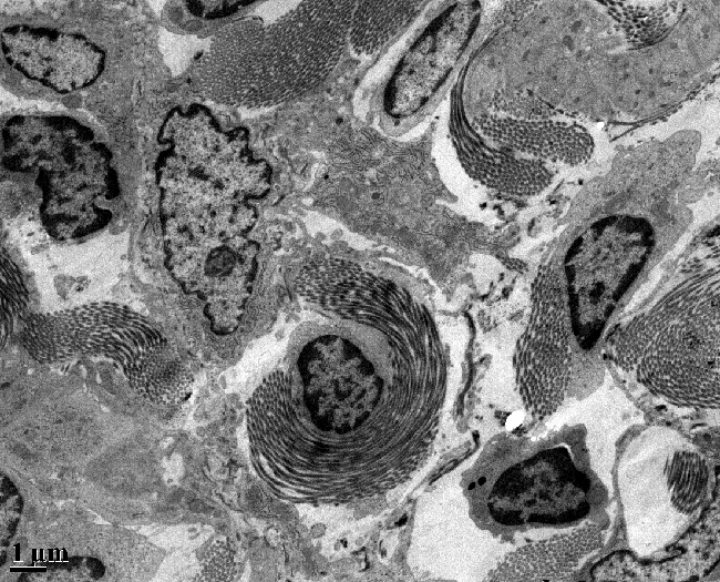 Connective Tissue in Mouse Kidney connective tissue in a mouse kidney, taken with a transmission electron microscope