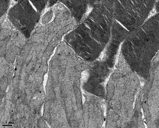 Photoreceptor Cells of Mouse Retina photoreceptor cells of a mouse retina, taken with a transmission electron microscope
