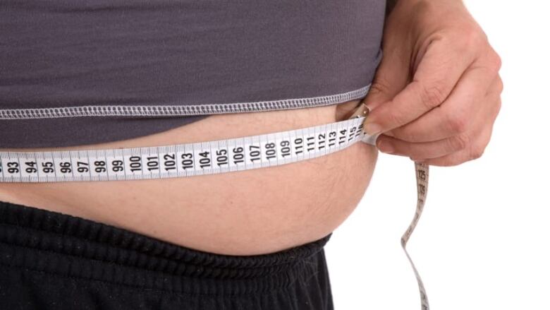Obesity stock photo
