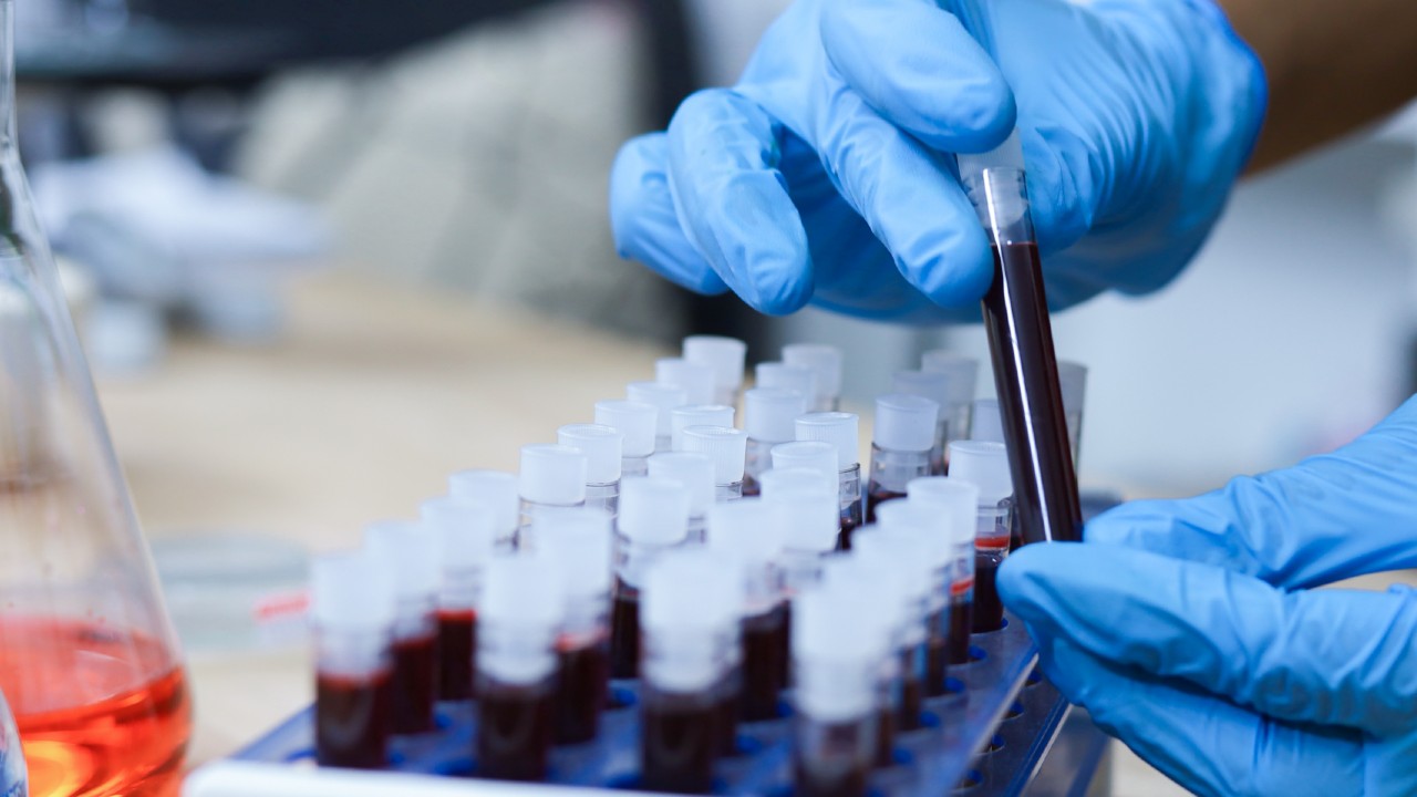A hand with a blue latex glove holding a blood sample while many other samples are in a holder.